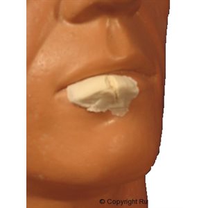 Large Split / cut Lip